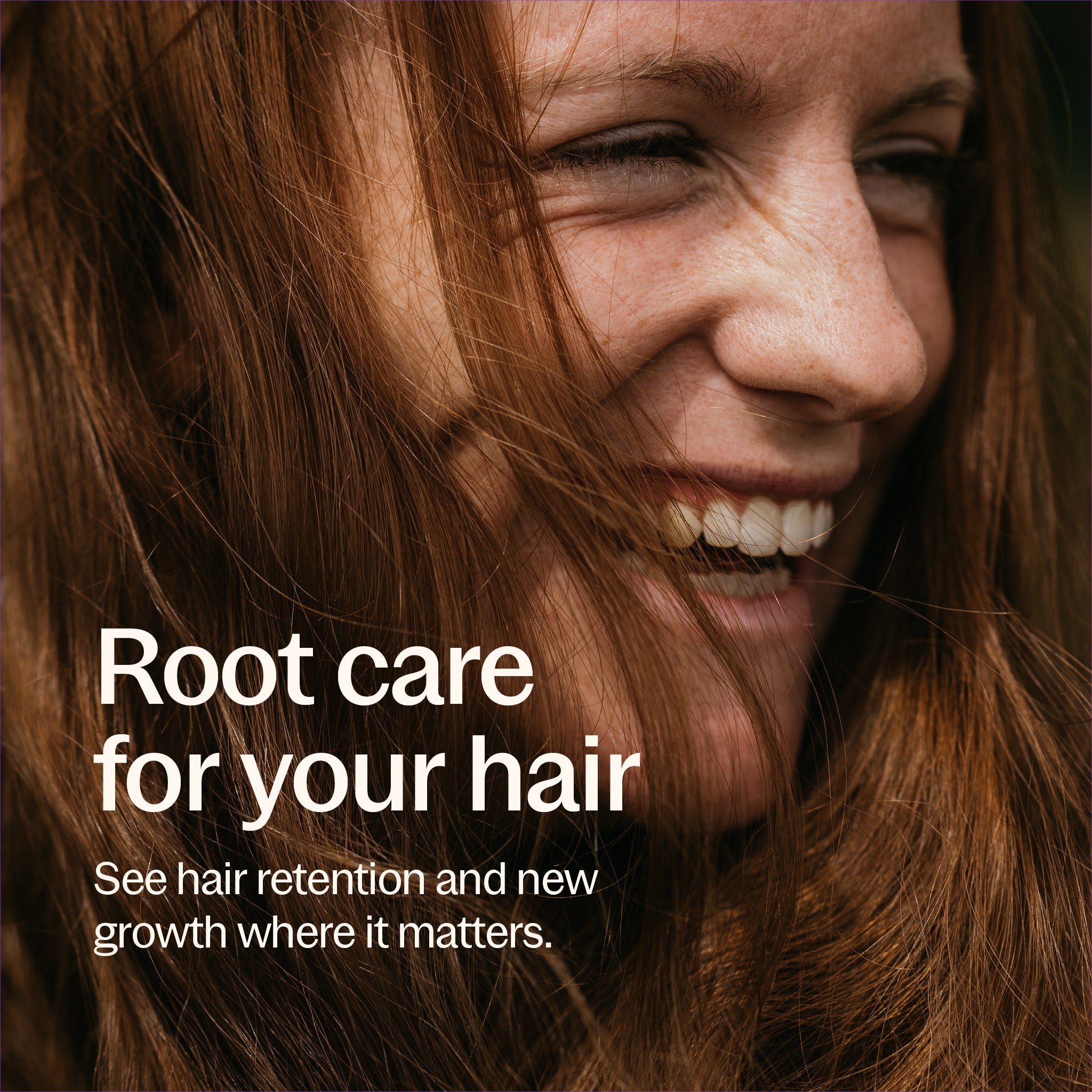Root care for your hair See hair retention and new growth where it matters